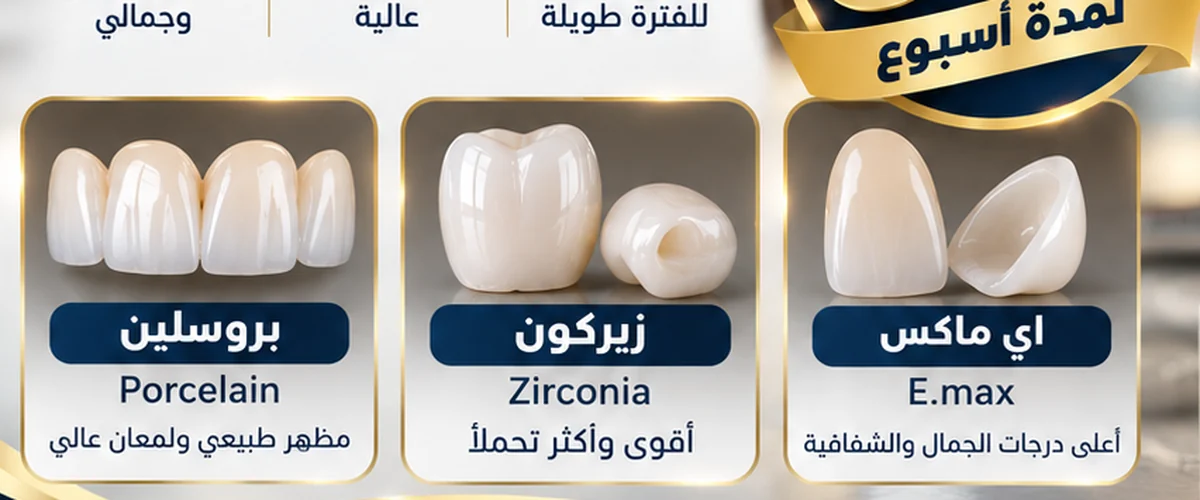 زيركون E-max وبورسلين لتركيبات الأسنان