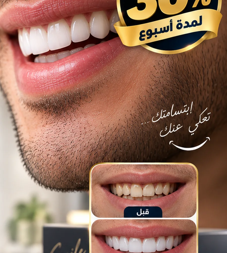 هوليود سمايل في Ezz Dental Clinic مدينة نصر