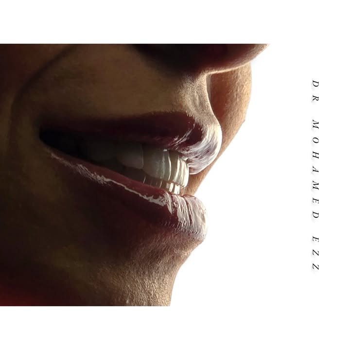 ابتسامة جديدة - Ezz Dental Clinic مدينة نصر