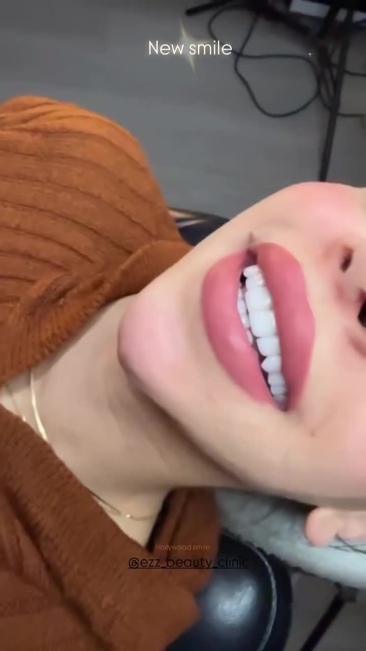 ابتسامة جديدة من العيادة - Ezz Dental Clinic مدينة نصر