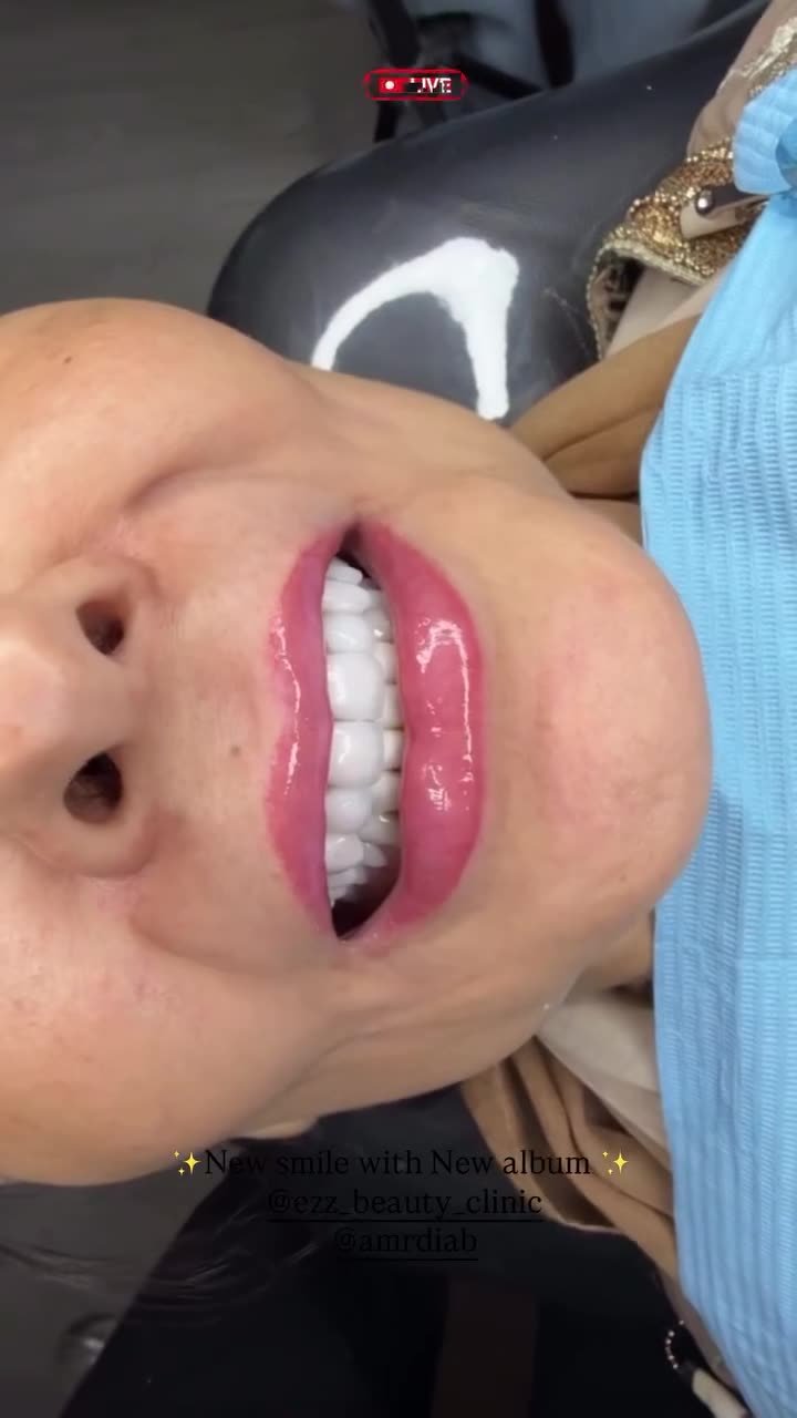 ابتسامة جديدة من العيادة - Ezz Dental Clinic مدينة نصر