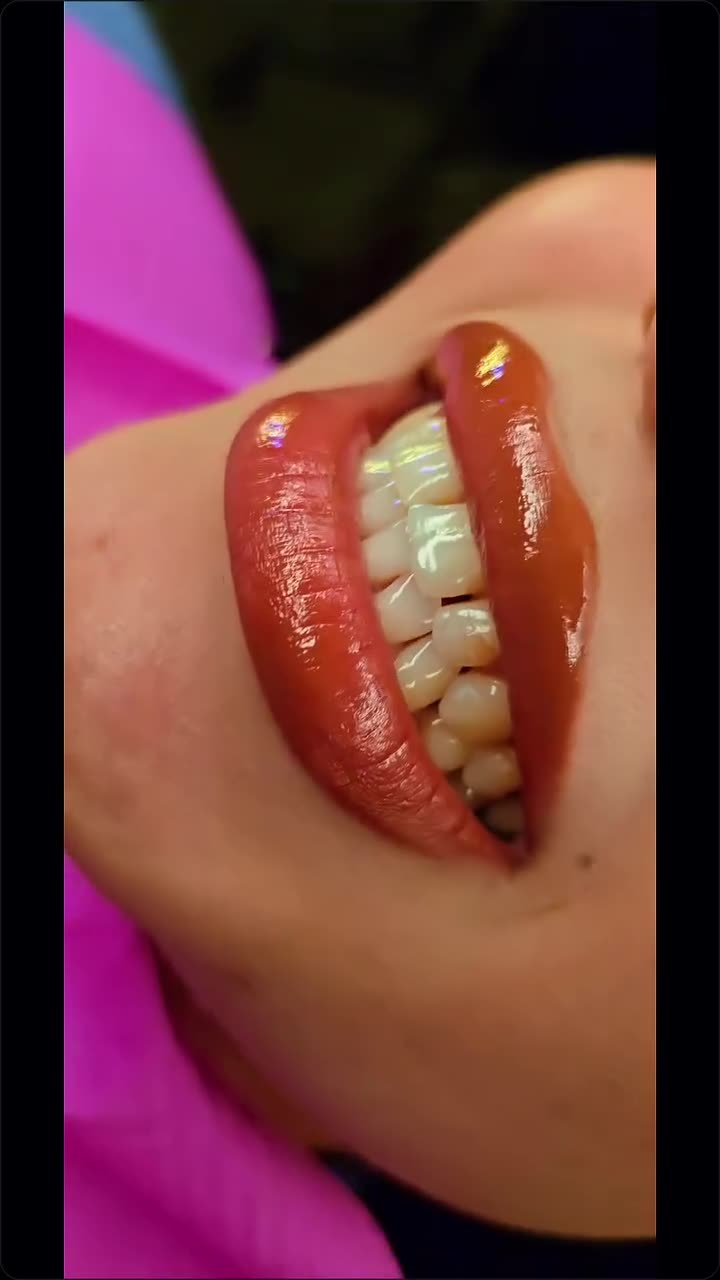 ابتسامة جديدة من العيادة - Ezz Dental Clinic مدينة نصر