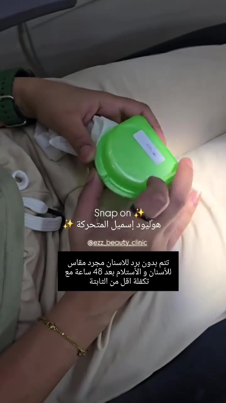 هوليود سمايل المتحركة Snap-on - Ezz Dental Clinic مدينة نصر